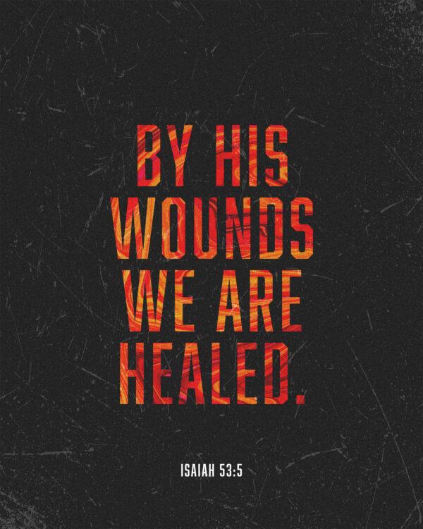 By his wounds we are healed. – Isaiah 53:5