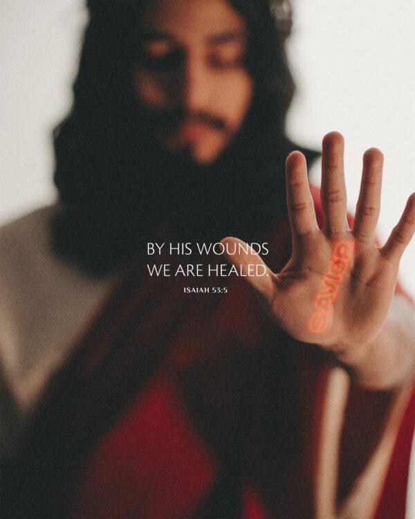 By his wounds we are healed. – Isaiah 53:5